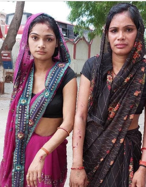 Hathras: Married woman who went to her in-laws' house to pick up the innocent was beaten up in front of the police