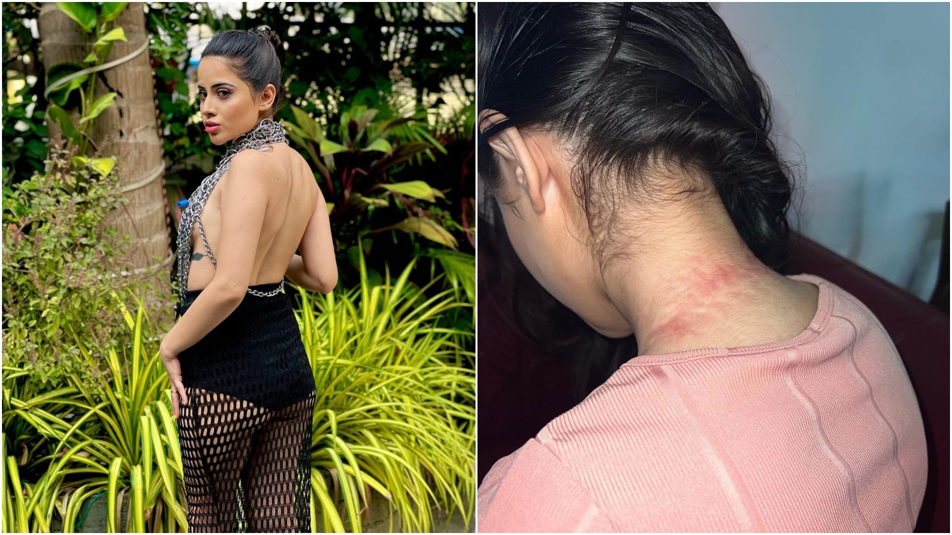 Urfi Javed Shares Her Injured neck photo after wearing outfit with chains See in Latest Photos News in Hindi