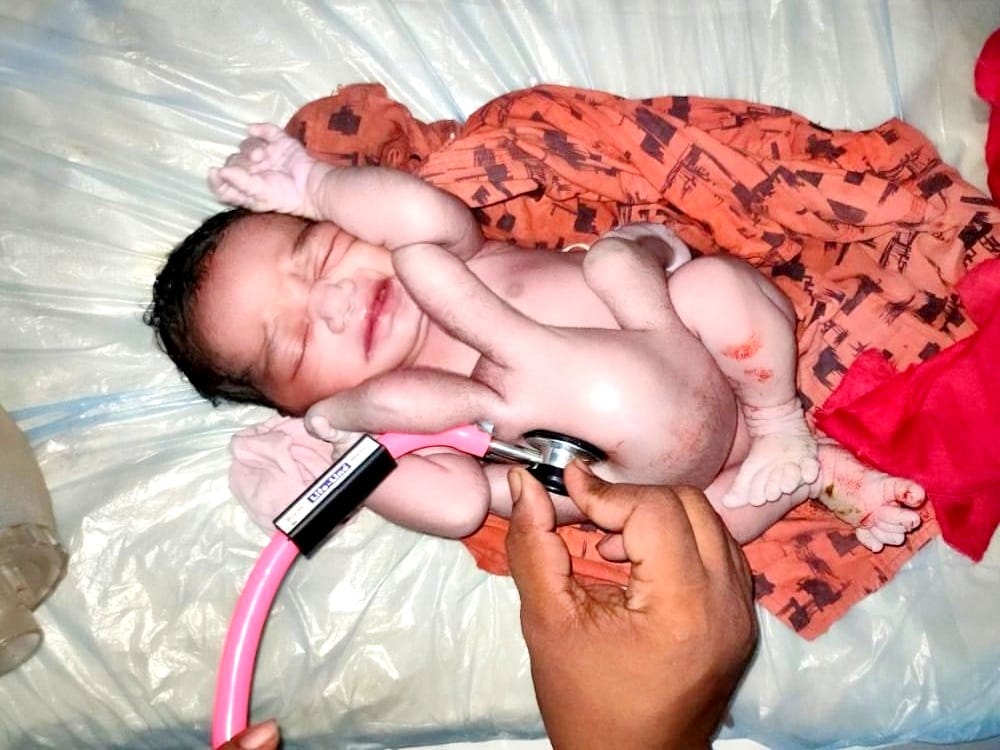 Birth of a child with four hands and four legs in Hardoi, people told the incarnation of God