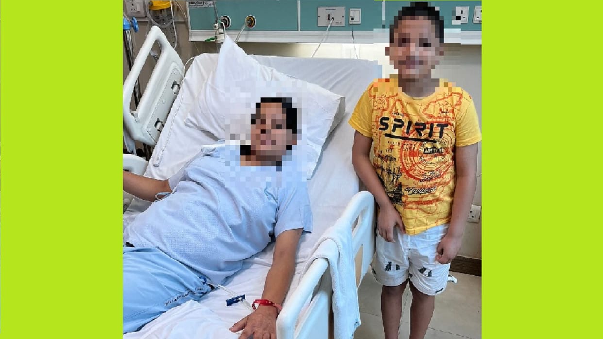 Doctors of Delhi s Sir Ganga Hospital performed a rare surgery and saved lives of two children
