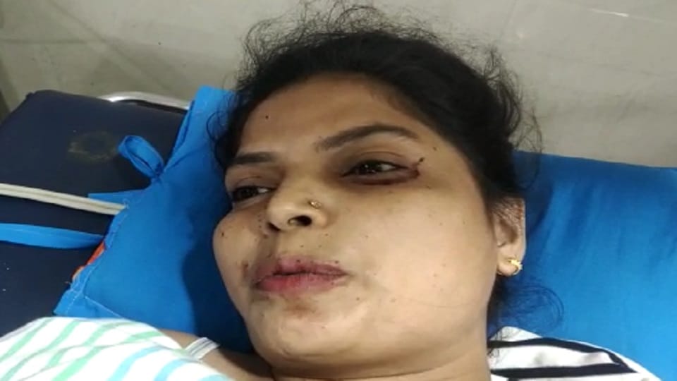 A husband shot his wife drunk in Aligarh s Civil Lines police station area