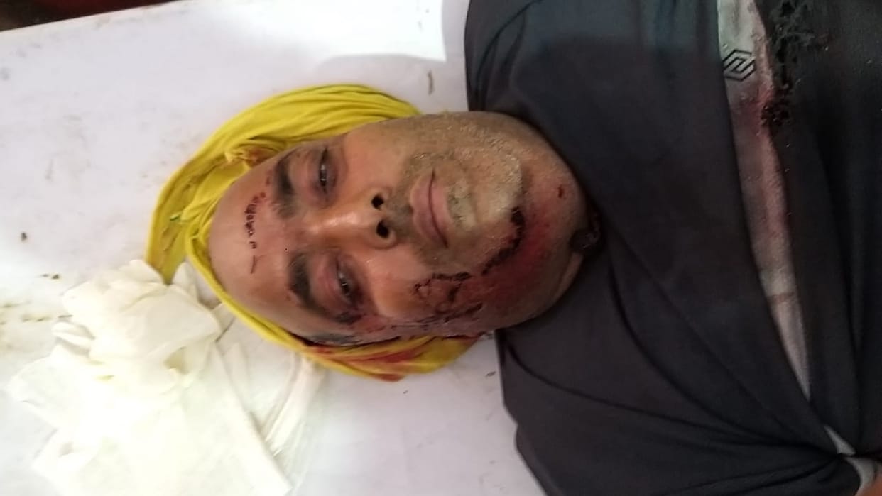 miscreants shot advocate who went out for a walk on the farm in sambhal
