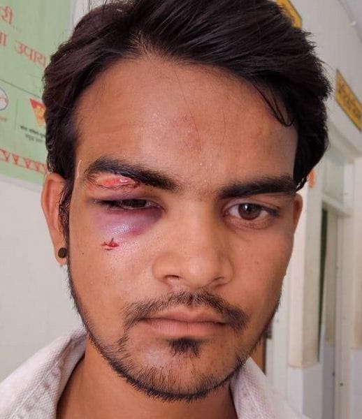 Hathras: The youth who entered the procession with a gun, beat up the groom and the bridesmaids