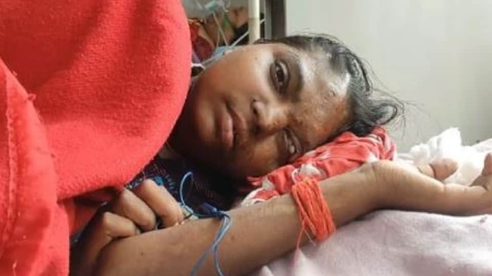Deepika Padukone Film Chhapaak co-star and acid attack survivor Bala critical condition due to kidney failure