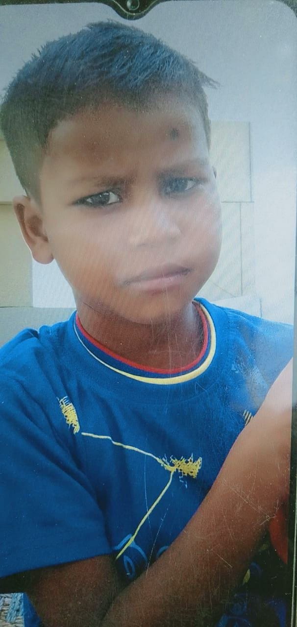 Hathras: Child dies due to snakebite