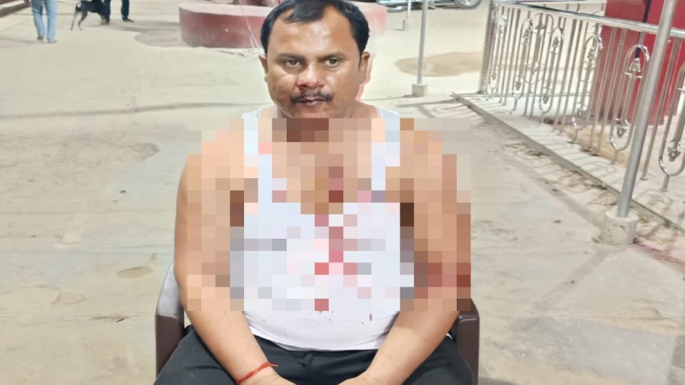 RaeBareili Deadly attack on Jamunapur Vyapar Mandal President and his associates injured