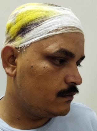 Farrukhabad: History sheeter entered the house and attacked, case registered