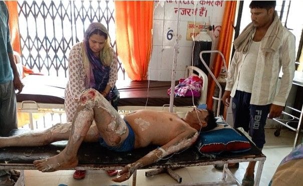 Hathras: Gas leak caused fire in cylinder, one person scorched