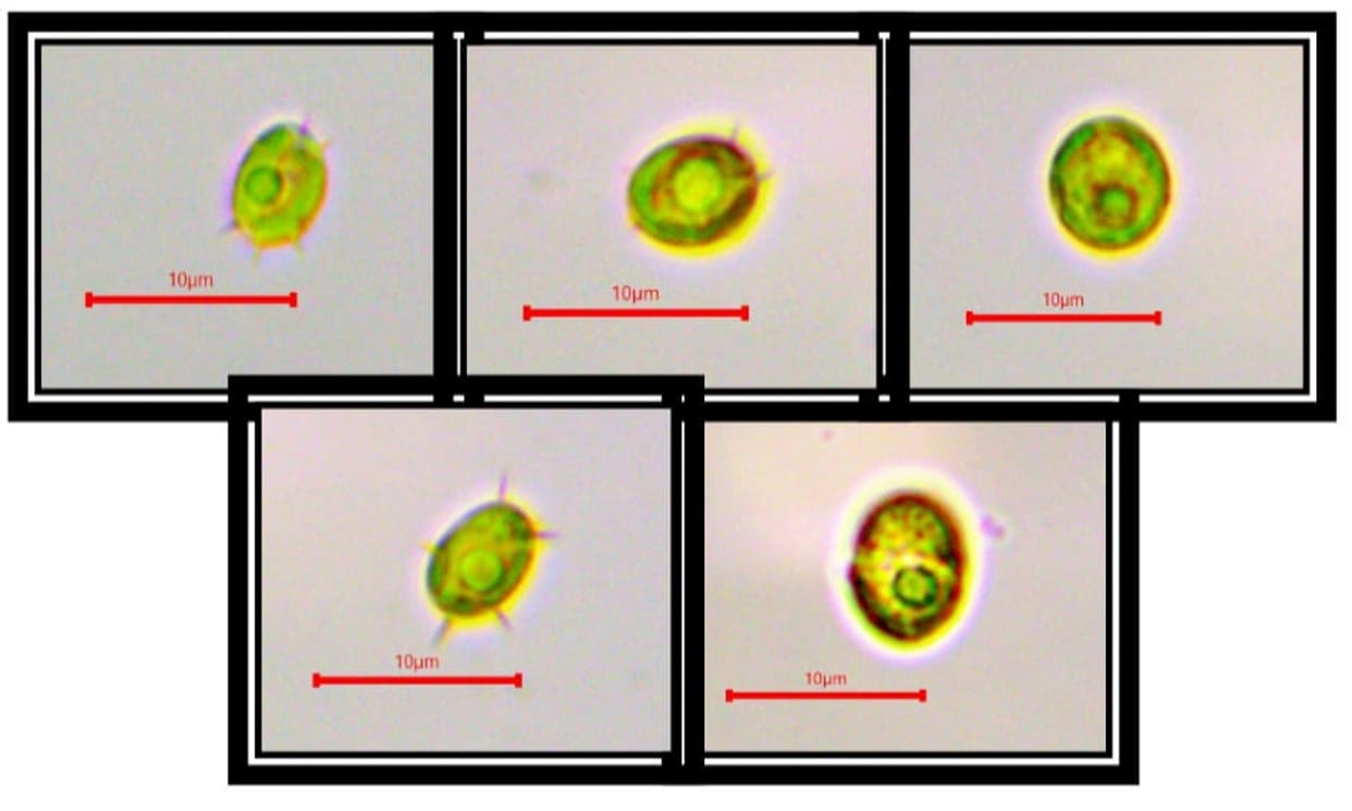 Rare species of moss found in Badrinath, Biodiesel, discovery of Microbiology Department of Garhwal University
