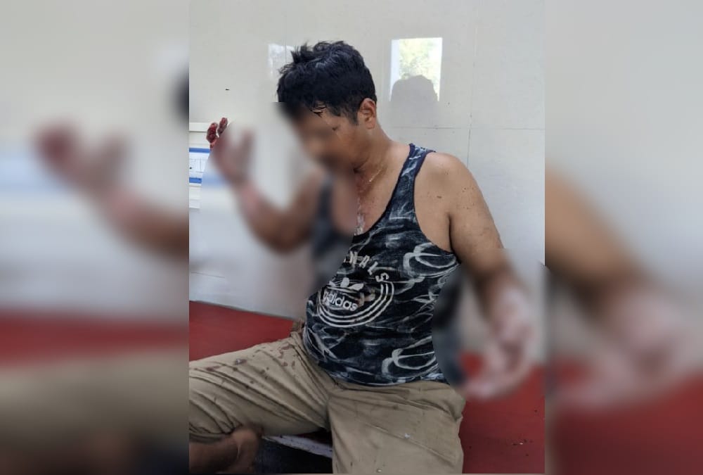 Uttarakhand News Today: Deadly attack on policemen in Rudrapur