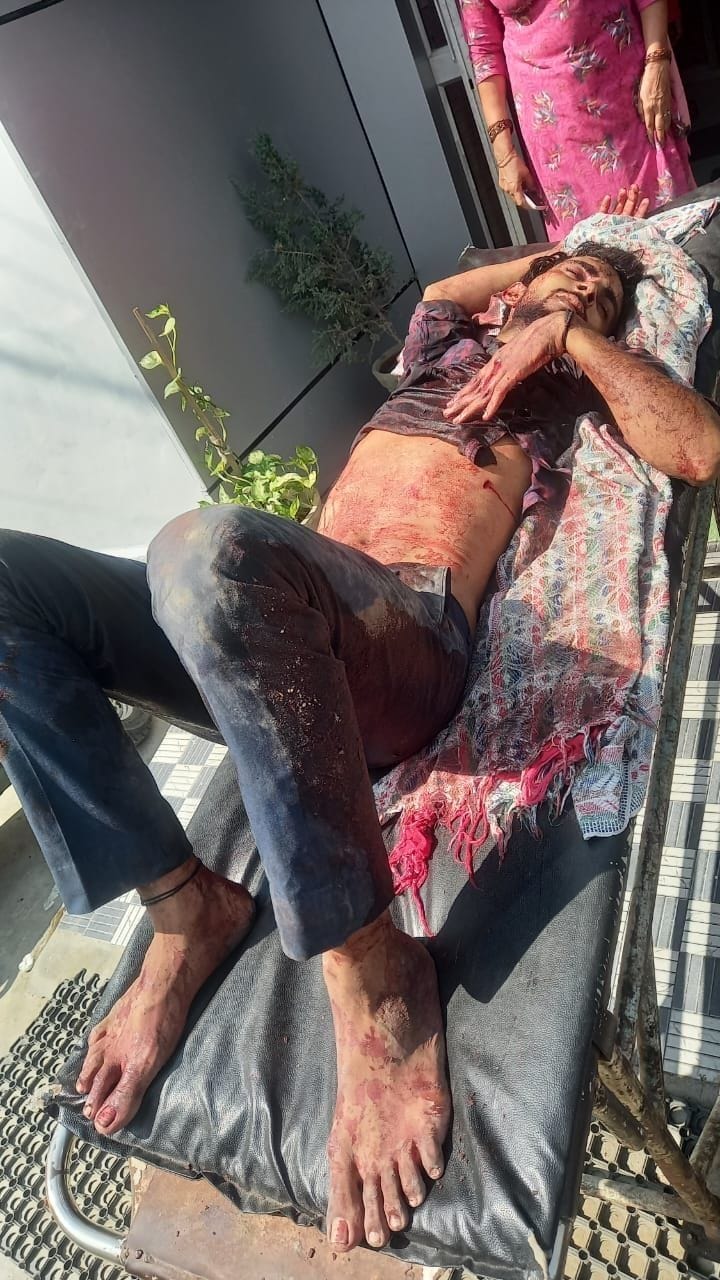Knife in Datauli village, a young man seriously injured