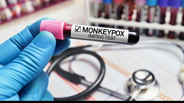 Indian scientists found duration of Monkeypox antibody is 226 days using indigenous technology