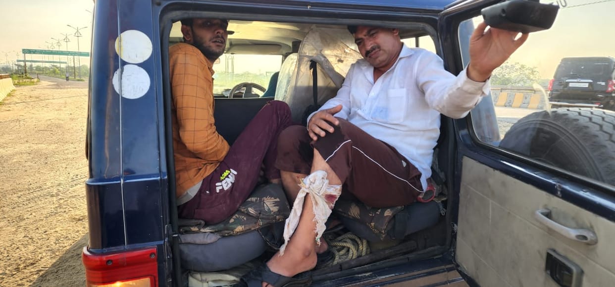 Police Encounter in Meerut, two cooks injured in encounter