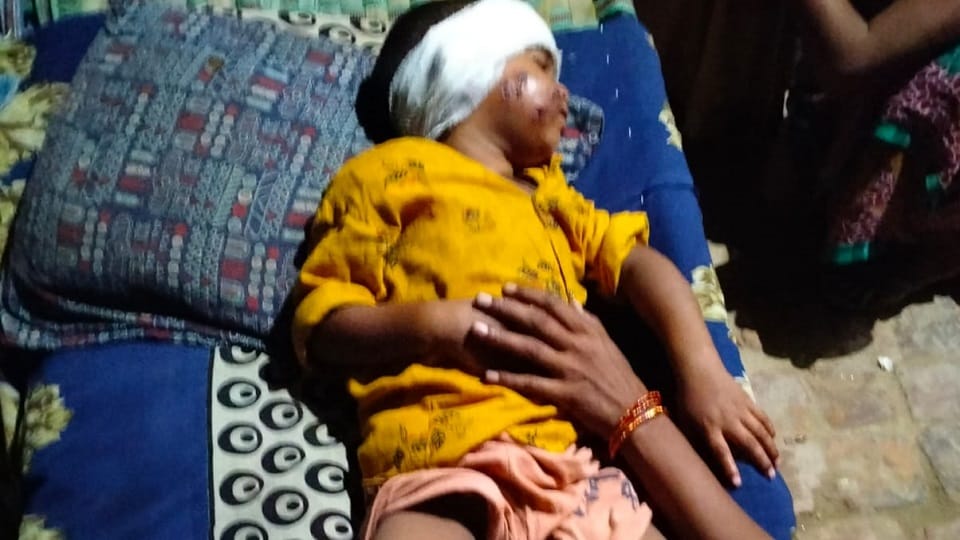 two and a half year old child injured by a german shepherd dog in lucknow sairpur police station area