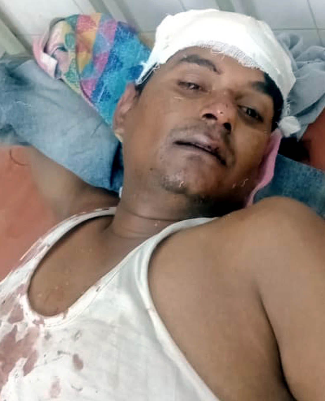 Driver injured in collision of two cars on EPE