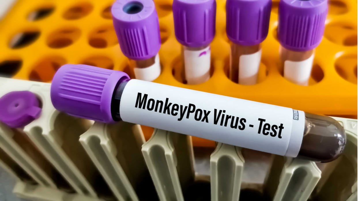Eighth patient of monkeypox found in Delhi