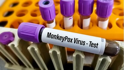 Fifth case of monkeypox surfaced in Delhi