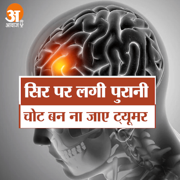 A CHRONIC HEAD INJURY CAN CAUSE BRAIN TUMOR