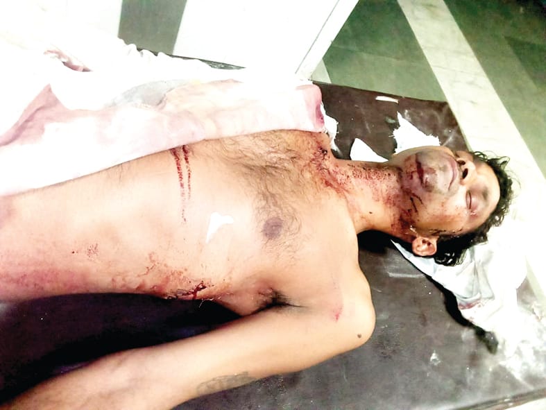 Attack on a worker walking outside the house with ax and razor