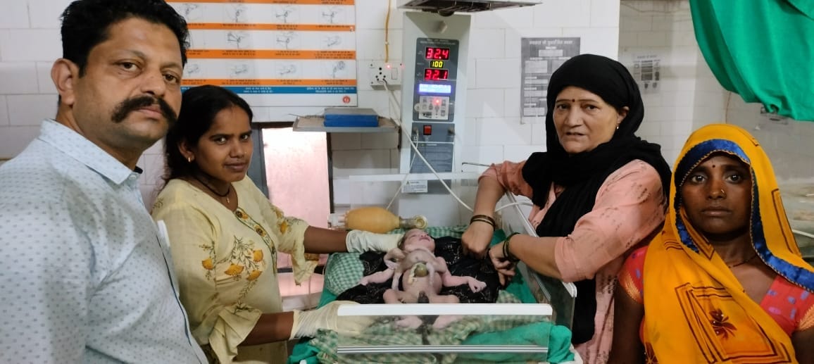 Birth of a child with four hands and four legs in Unnao, people told the incarnation of God