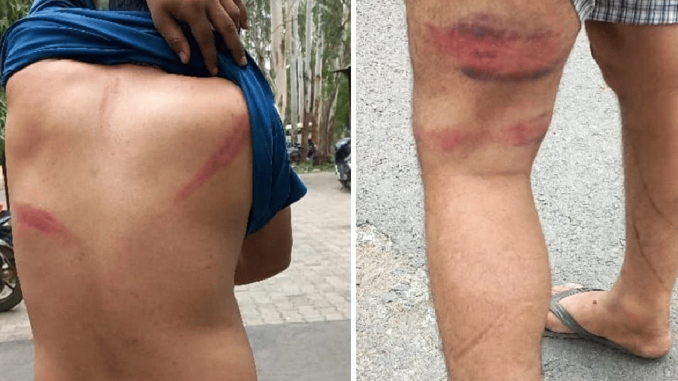 Madhya Pradesh News: When the truck of BJP MLA's son was stopped, forest workers were beaten up, firing in the