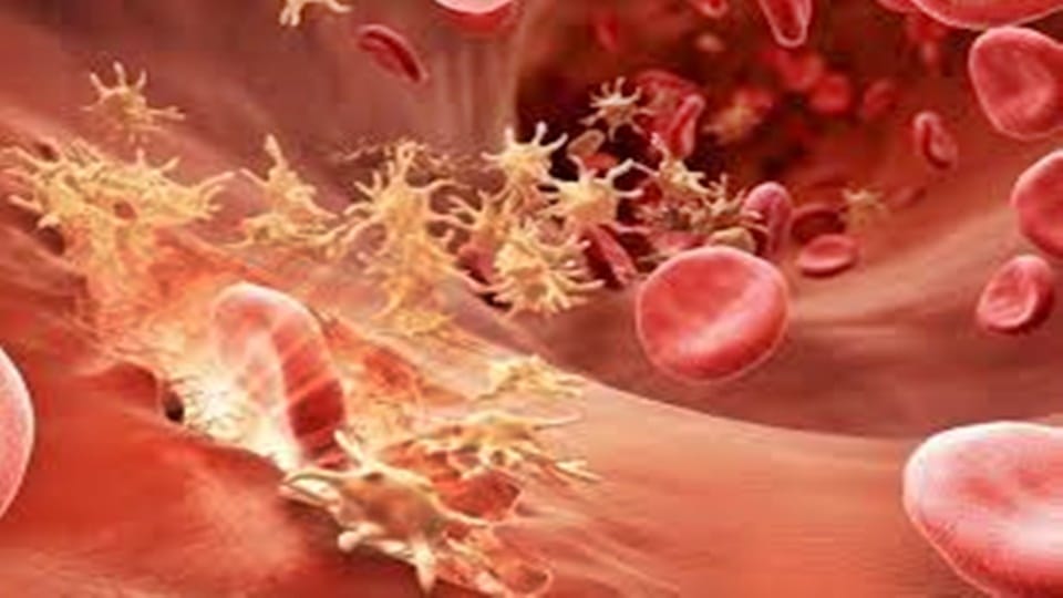 Haemophilia Now bleeding treatment will be Virus British doctors successfully treated sick patient from birth