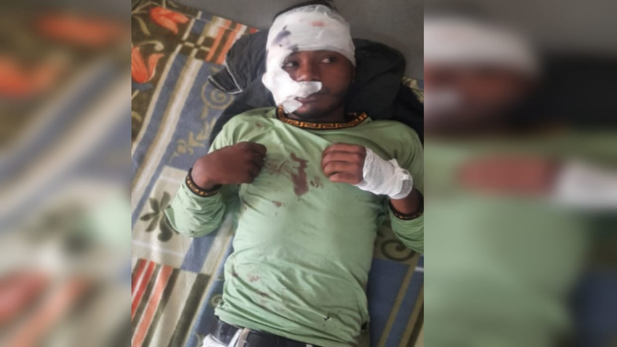 Meerut: Youth injured due to bike slipping, hospital denied to provide bed, treatment by lying on the floor