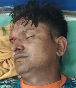 Farrukhabad: Two Kanwariyas injured, one serious due to vehicle collision