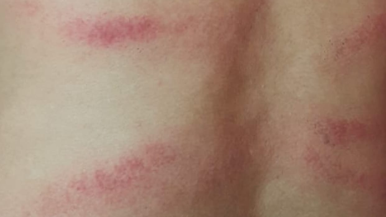 Police beat two youth for complaint about selling liquor on contract late night