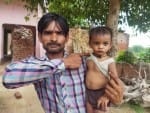 दवा से रिएक्शन की वजह से बच्चे के शरीर पर बने निशान दिखाता उसका पिता ।संवाद