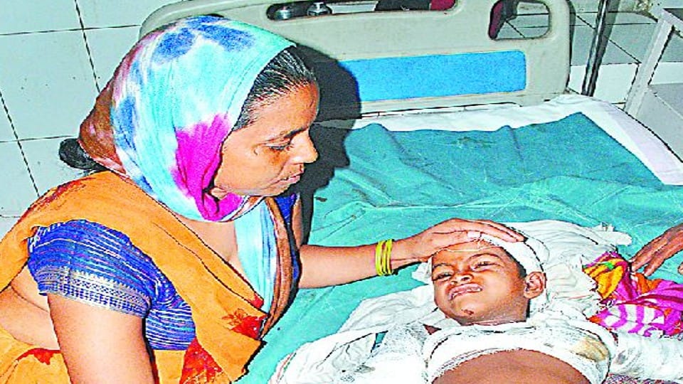 ten year old girl died who injured in attack of street dogs in agra