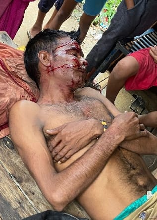 Farmer injured in tiger attack