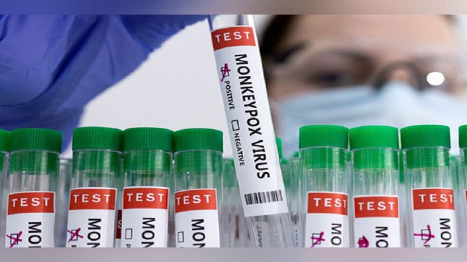 monkeypox update in india and latest symptoms in hindi