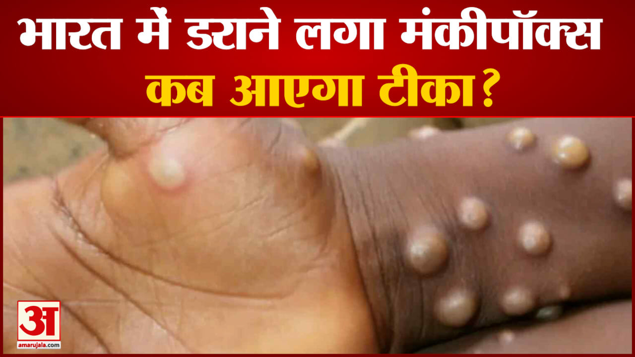 Monkeypox