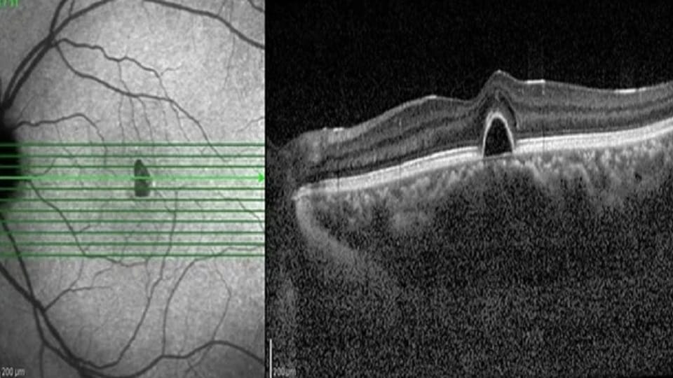 Artificial intelligence based technology will take care of Heart
