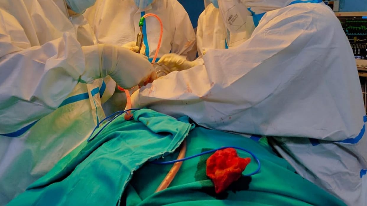 The patient was operated upon by using the name and registration of a famus doctor in Meerut