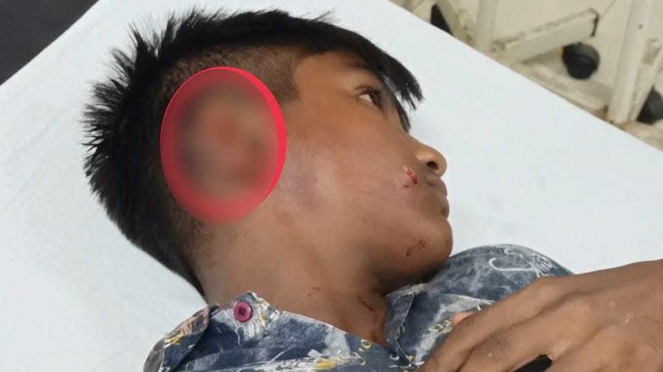 Pitbull dog bites on ear of boy in village Kotli Bham Singh of Batala