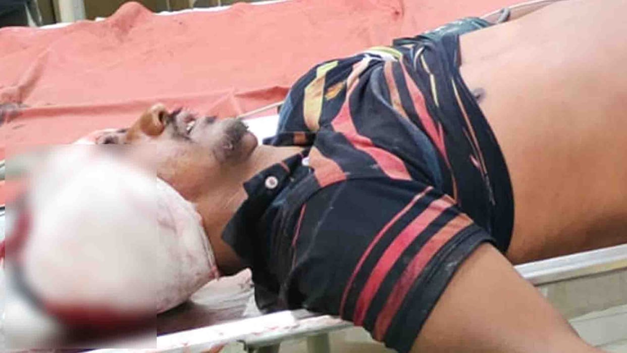 Farrukhabad: Petrol pump manager shot, condition critical