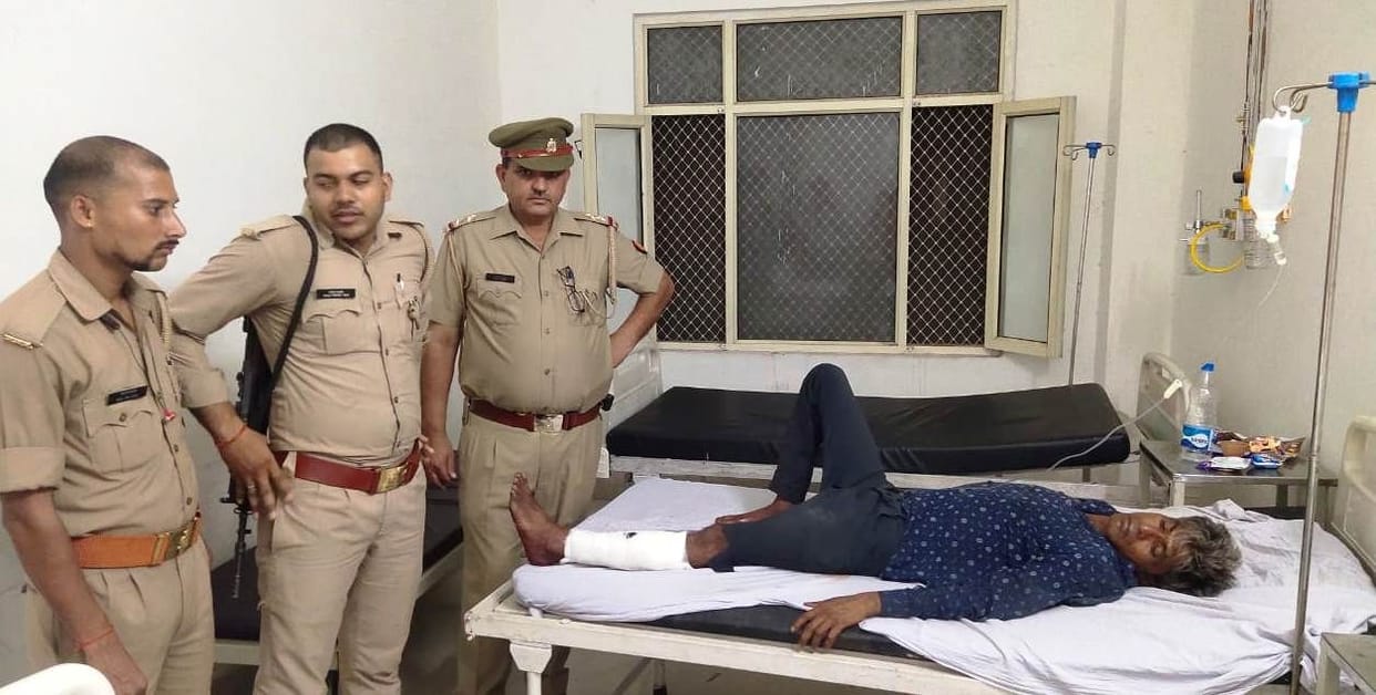 A miscreant got shot in the leg in the firing between the police and the miscreants