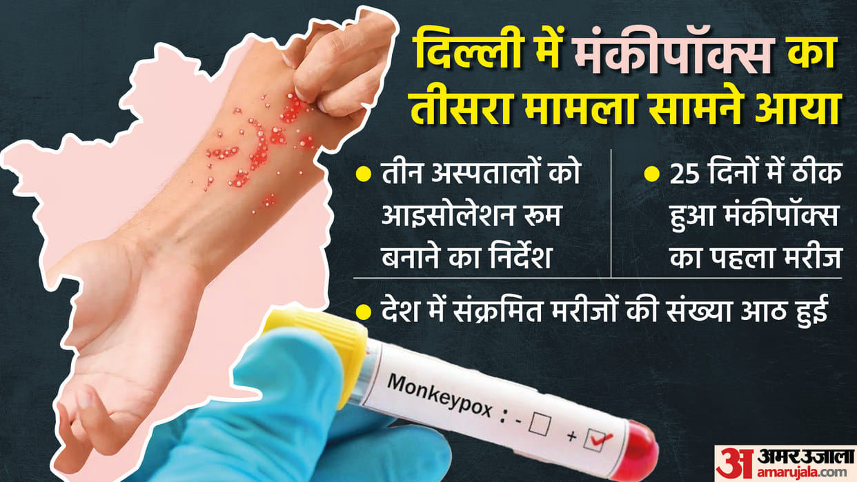 monkeypox in delhi india another Nigerian man tests positive for monkeypox