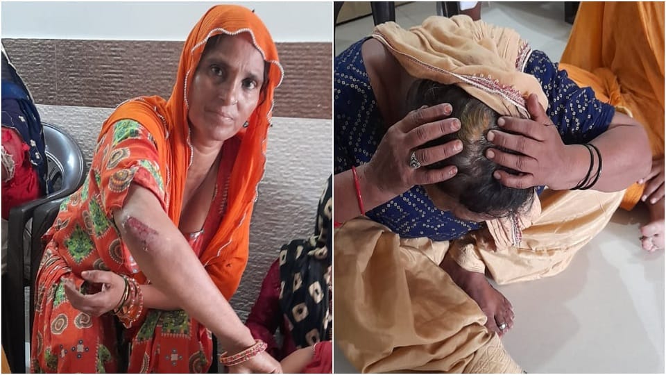 Lathi Charge on the women who came to rescue the accused of molestation in etah