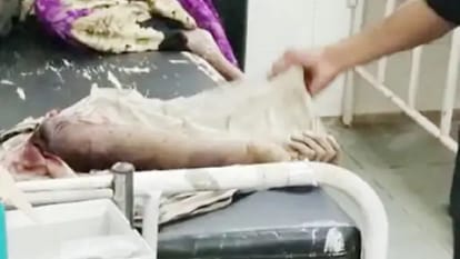 Son's hand cut off for not giving bike in Damoh, father reached police station with severed hand