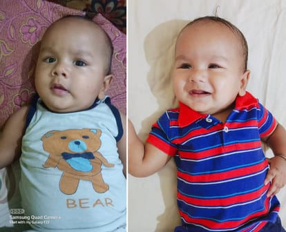 Rare Disease: Rs 16 crore needed to save this innocent life suffered with SMA Type-1