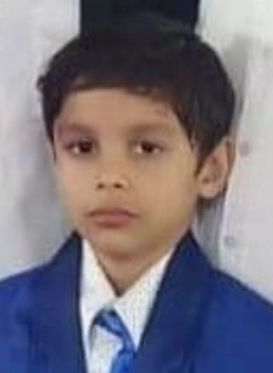 scorched child dies due to battery explosion