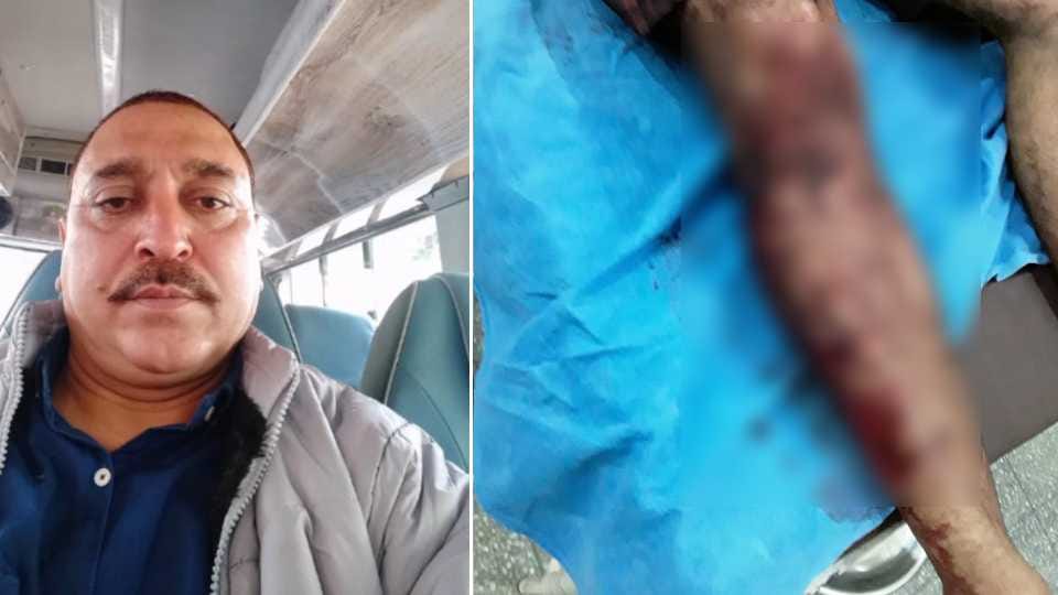 Pitbull dog attacked the owner in Ropar of Punjab