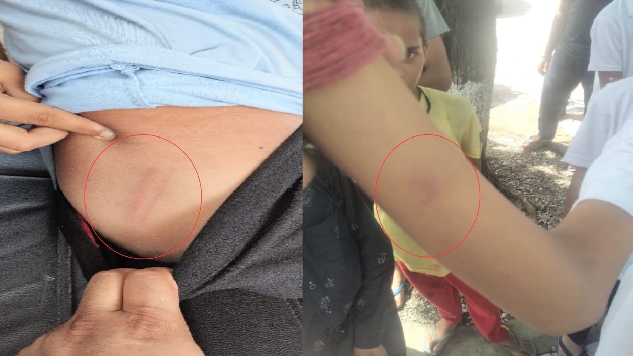 House teacher beat 15 students in JNV Dungri, parents created ruckus