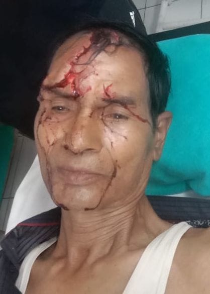Leopard attacks Ex armyMan