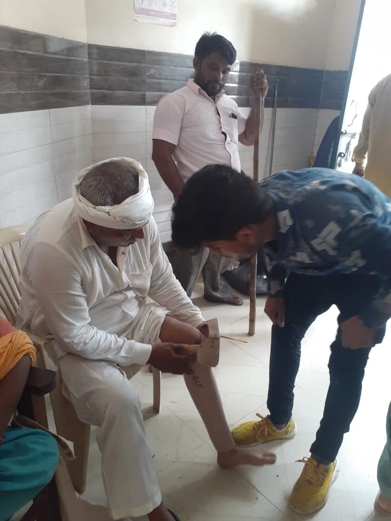 Divyangjan swing by getting prosthesis