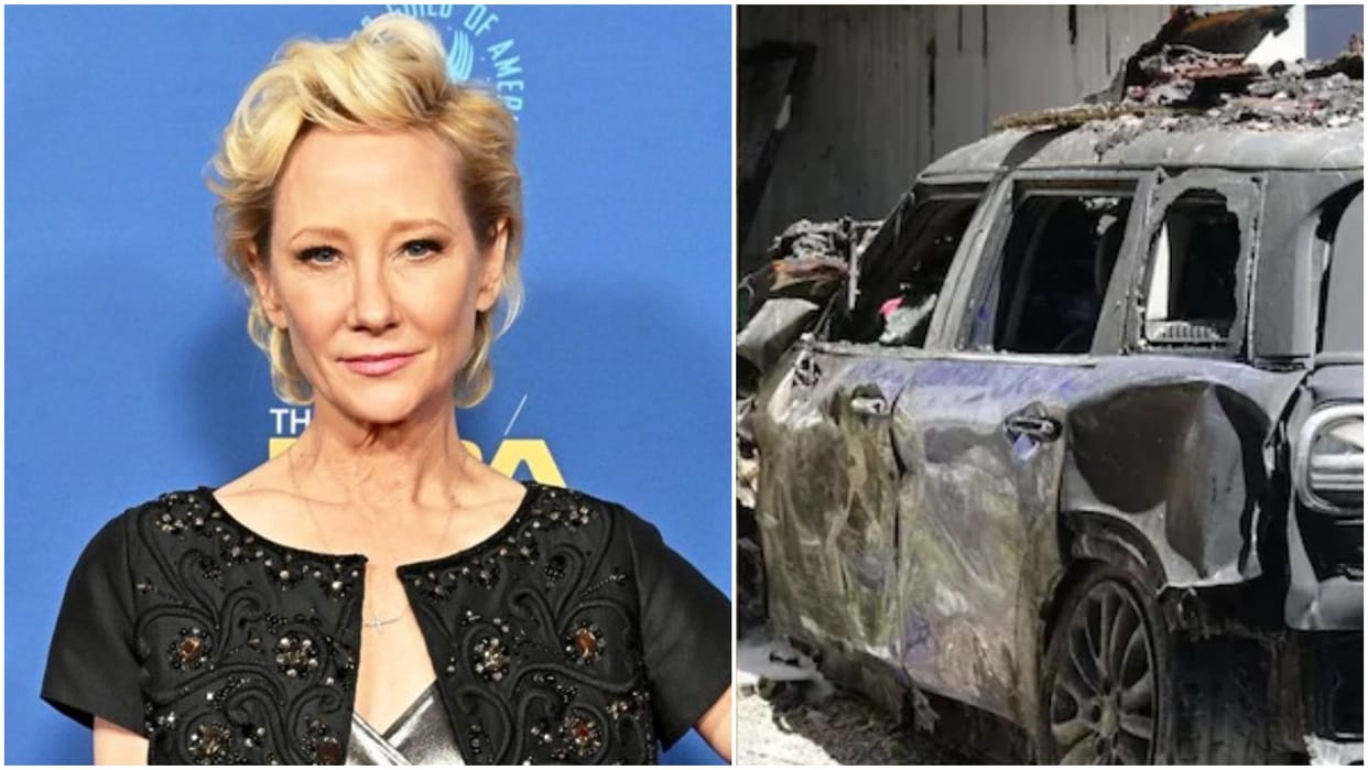 Hollywood: Anne Heche Car Accident actress burned severely and is hospitalised in serious condition