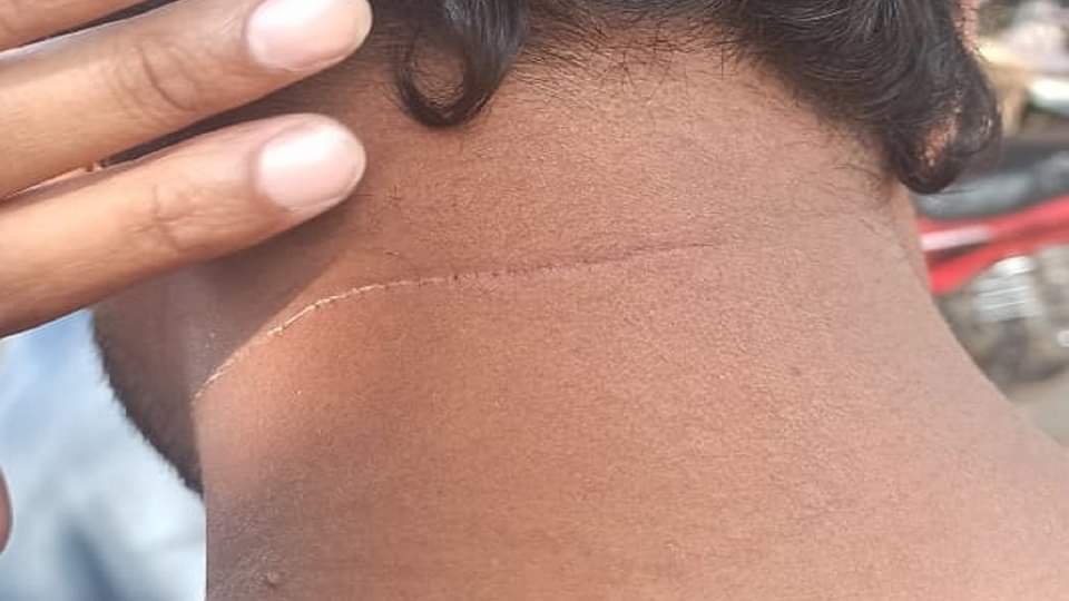 in action against chinese manjha till july 31 this year delhi police registered 145 cases and arrested 140 peo